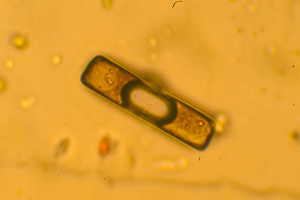 Kieselalge im Wassertropfen