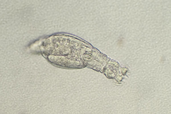 Rdertierchen im Wassertropfen